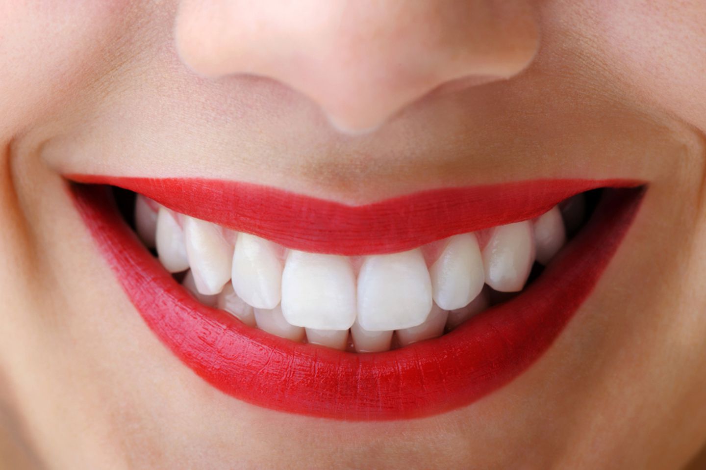 Улыбка картинки. Красивые зубы. Улыбка. Белоснежная улыбка. Красивая форма зубов.